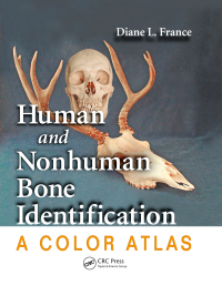 صورة الغلاف: Human and Nonhuman Bone Identification 1st edition 9780367777913