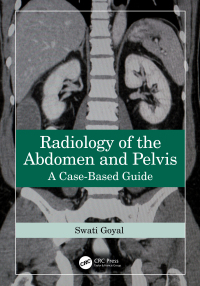 Cover image: Radiology of the Abdomen and Pelvis 1st edition 9781032587745