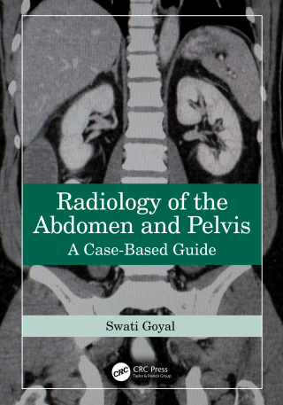 صورة الغلاف: Radiology of the Abdomen and Pelvis 1st edition 9781032587745