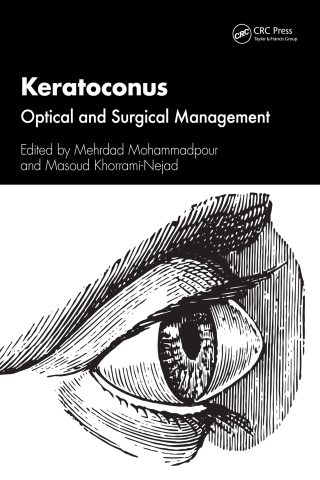 Cover image: Keratoconus 1st edition 9781032443256