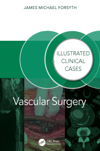 Titelbild: Vascular Surgery: Illustrated Clinical Cases 1st edition 9781032804811