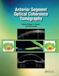 Cover image: Anterior Segment Optical Coherence Tomography 1st edition 9781556428081