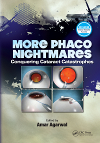 Cover image: More Phaco Nightmares 1st edition 9781630914394