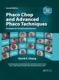 Cover image: Phaco Chop and Advanced Phaco Techniques 2nd edition 9781617110757