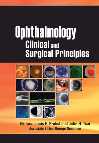 Cover image: Ophthalmology 1st edition 9781556427350