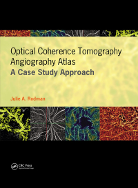 Cover image: Optical Coherence Tomography Angiography Atlas 1st edition 9781630916411