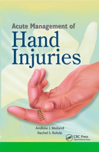 Cover image: Acute Management of Hand Injuries 1st edition 9781556428531