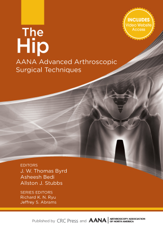 Cover image: The Hip 1st edition 9781630910006