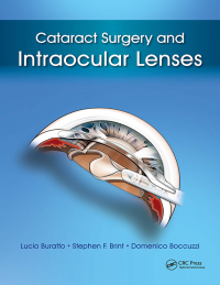 صورة الغلاف: Cataract Surgery and Intraocular Lenses 1st edition 9781617116049