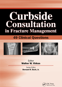 Cover image: Curbside Consultation in Fracture Management 1st edition 9781556428296