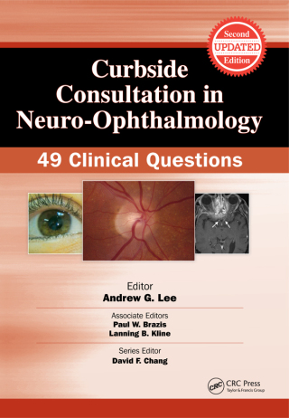 Immagine di copertina: Curbside Consultation in Neuro-Ophthalmology 2nd edition 9781617116377