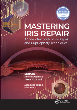 Cover image: Mastering Iris Repair 1st edition 9781630917265