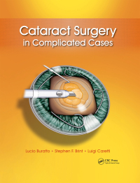 Omslagafbeelding: Cataract Surgery in Complicated Cases 1st edition 9781617116070