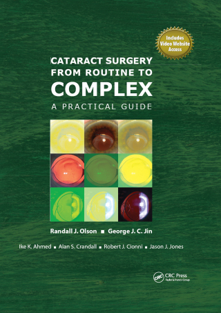 Cover image: Cataract Surgery from Routine to Complex 1st edition 9781556429477