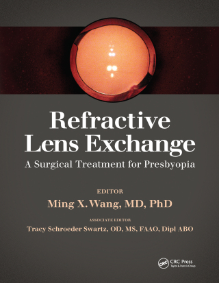 Cover image: Refractive Lens Exchange 1st edition 9781041257516