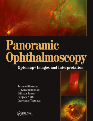 Cover image: Panoramic Ophthalmoscopy 1st edition 9781556427800