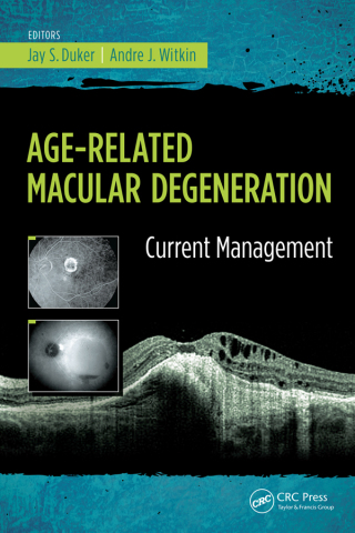 Cover image: Age-Related Macular Degeneration 1st edition 9781617116421