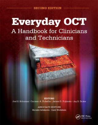 Cover image: Everyday OCT 2nd edition 9781630911720