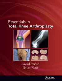 Cover image: Essentials in Total Knee Arthroplasty 1st edition 9781556428517