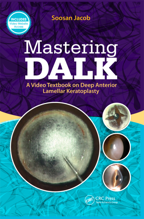 Mastering DALK: A Video Textbook on Deep Anterior Lamellar Keratoplasty, 1st Edition - FULL INSTANT DOWNLOAD | PDF DOCX EPUB