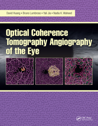 Cover image: Optical Coherence Tomography Angiography of the Eye 1st edition 9781630912826