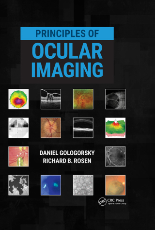 Cover image: Principles of Ocular Imaging 1st edition 9781630915995