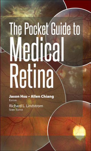 Cover image: The Pocket Guide to Medical Retina 1st edition 9781630916329
