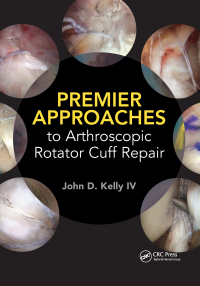 Imagen de portada: Premier Approaches to Arthroscopic Rotator Cuff Repair 1st edition 9781630915629