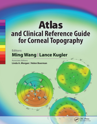 Cover image: Atlas and Clinical Reference Guide for Corneal Topography 1st edition 9781617110276