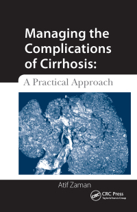 Imagen de portada: Managing the Complications of Cirrhosis 1st edition 9781556429576