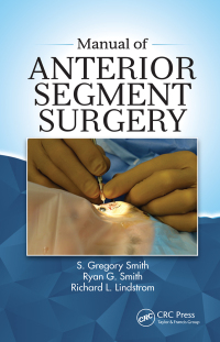 Immagine di copertina: Manual of Anterior Segment Surgery 1st edition 9781630916206