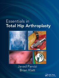 Cover image: Essentials in Total Hip Arthroplasty 1st edition 9781556428708