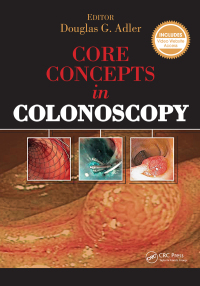 表紙画像: Core Concepts in Colonoscopy 1st edition 9781617116148