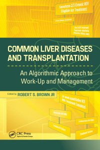 Titelbild: Common Liver Diseases and Transplantation 1st edition 9781556429033