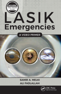 Cover image: LASIK Emergencies: A Video Primer 1st edition 9781630912628