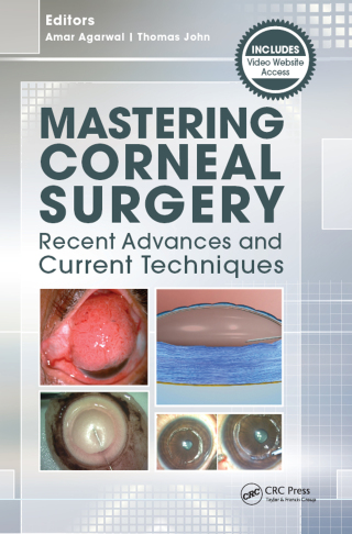 Imagen de portada: Mastering Corneal Surgery 1st edition 9781617116407