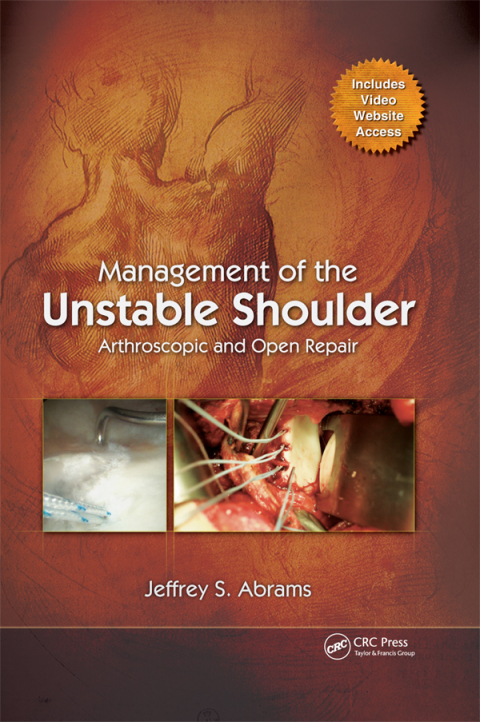 Management of the Unstable Shoulder: Arthroscopic and Open Repair, 1st Edition - FULL INSTANT DOWNLOAD | PDF DOCX EPUB