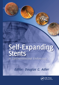 صورة الغلاف: Self-Expanding Stents in Gastrointestinal Endoscopy 1st edition 9781617110283