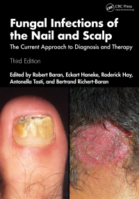 Cover image: Fungal Infections of the Nail and Scalp 3rd edition 9781032464305