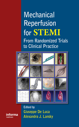 Imagen de portada: Mechanical Reperfusion for STEMI 1st edition 9781841846965
