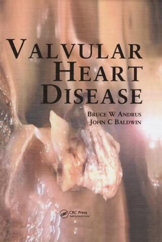Cover image: Valvular Heart Disease 1st edition 9781840760583