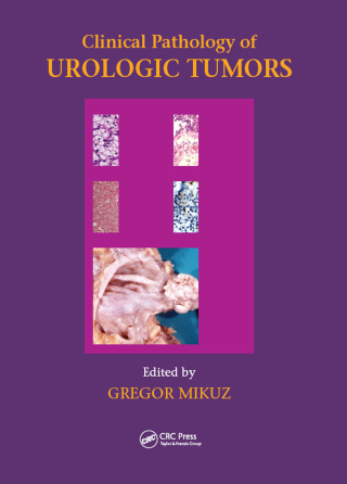 Cover image: Clinical Pathology of Urological Tumours 1st edition 9781841846194