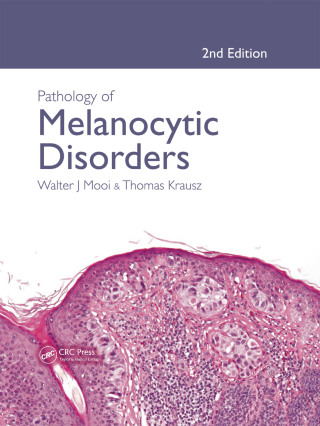 Cover image: Pathology of Melanocytic Disorders 2ed 2nd edition 9780340809686