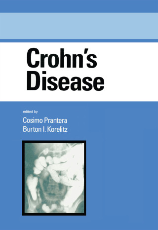 Cover image: Crohn's Disease 1st edition 9780824794101