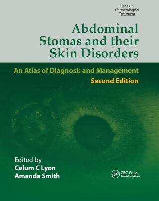 表紙画像: Abdominal Stomas and Their Skin Disorders 2nd edition 9781841844312