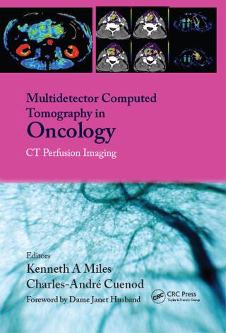 Cover image: Multi-Detector Computed Tomography in Oncology 1st edition 9781842143094