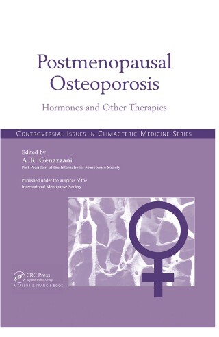 Immagine di copertina: Postmenopausal Osteoporosis 1st edition 9781842143117