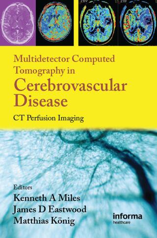 Cover image: Multidetector Computed Tomography in Cerebrovascular Disease 1st edition 9781842143155