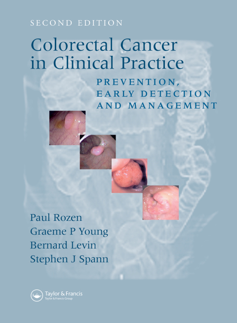 Colorectal Cancer in Clinical Practice: Prevention, Early Detection and Management, Second Edition, 2nd Edition - FULL INSTANT DOWNLOAD | PDF DOCX EPUB