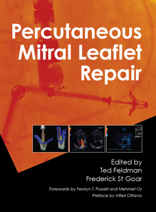 Imagen de portada: Percutaneous Mitral Leaflet Repair 1st edition 9780367576721